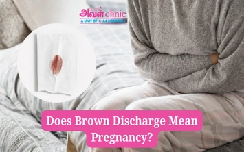 Does Brown Discharge Mean Pregnancy?