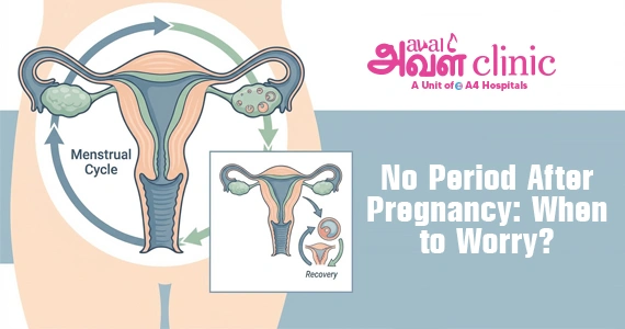 No Period After Pregnancy: When to Worry?