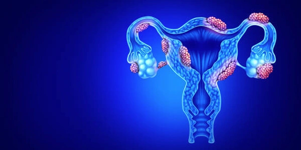 symptoms of uterine fibroids banner