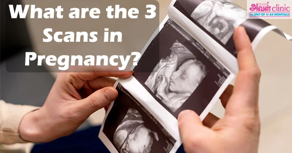 Can I Eat Raw Mango during Pregnancy banner 