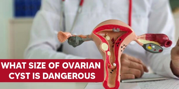 What size of ovarian cyst is dangerous