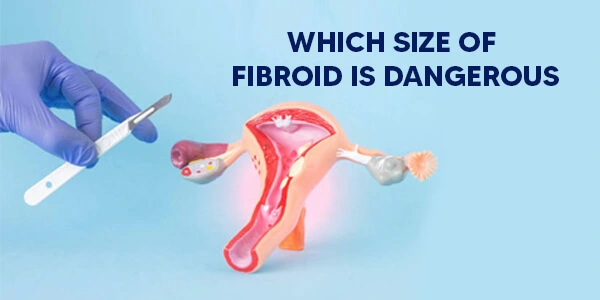 which size of fibroid is dangerous